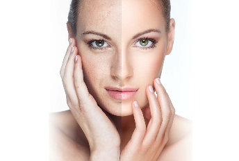 The result is the use of a cream VitalDermax becomes evident already after 15 minutes