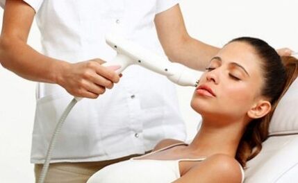 Laser for fractional laser regeneration