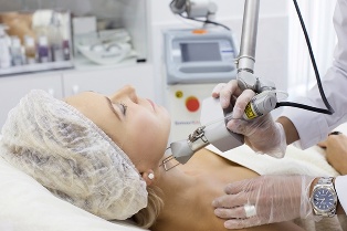 Beautician rejuvenates the skin with laser