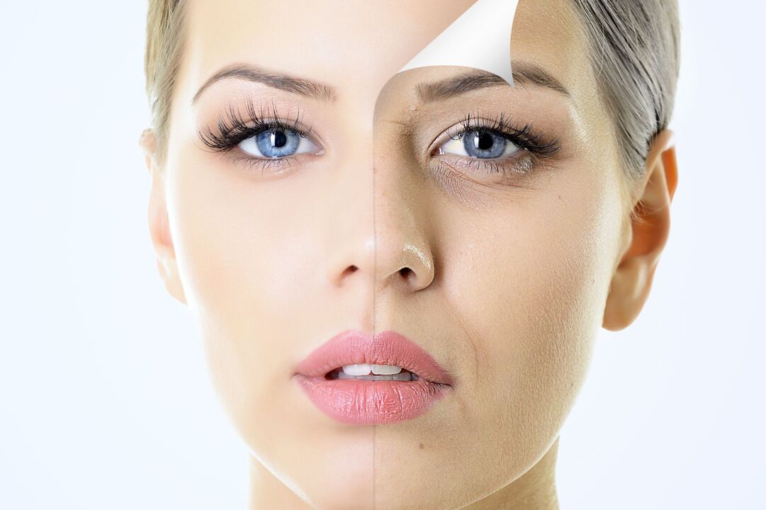 Rejuvenation of skin