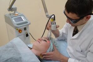 Laser Facial Rejuvenation Procedure
